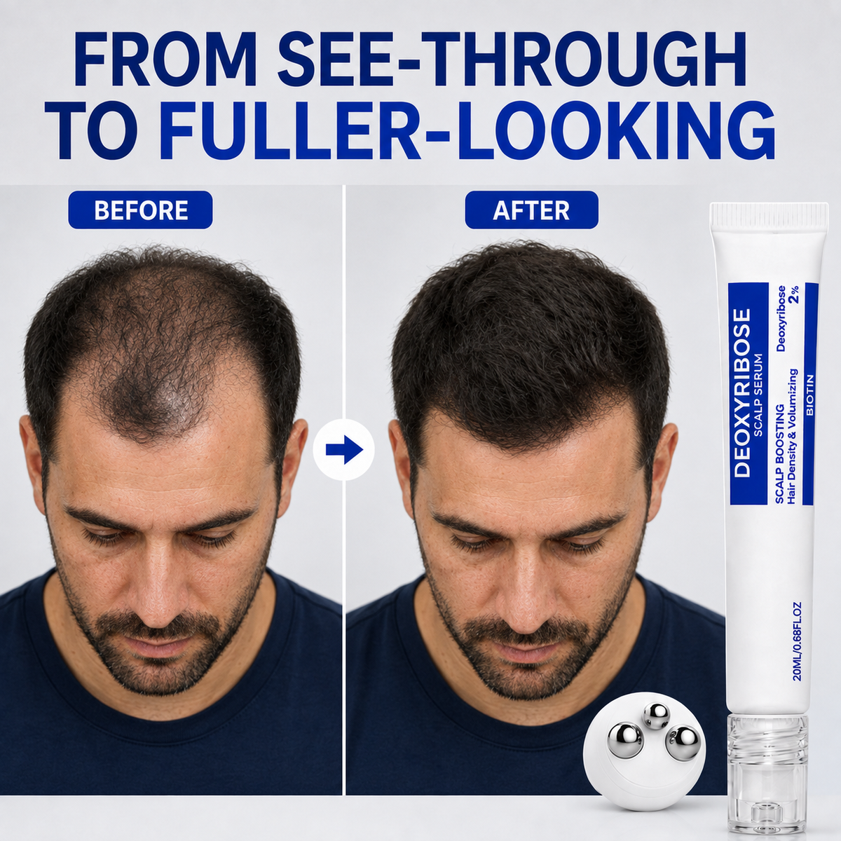 Craftaroq®-Deoxyribose Scalp Serum Roll-On
