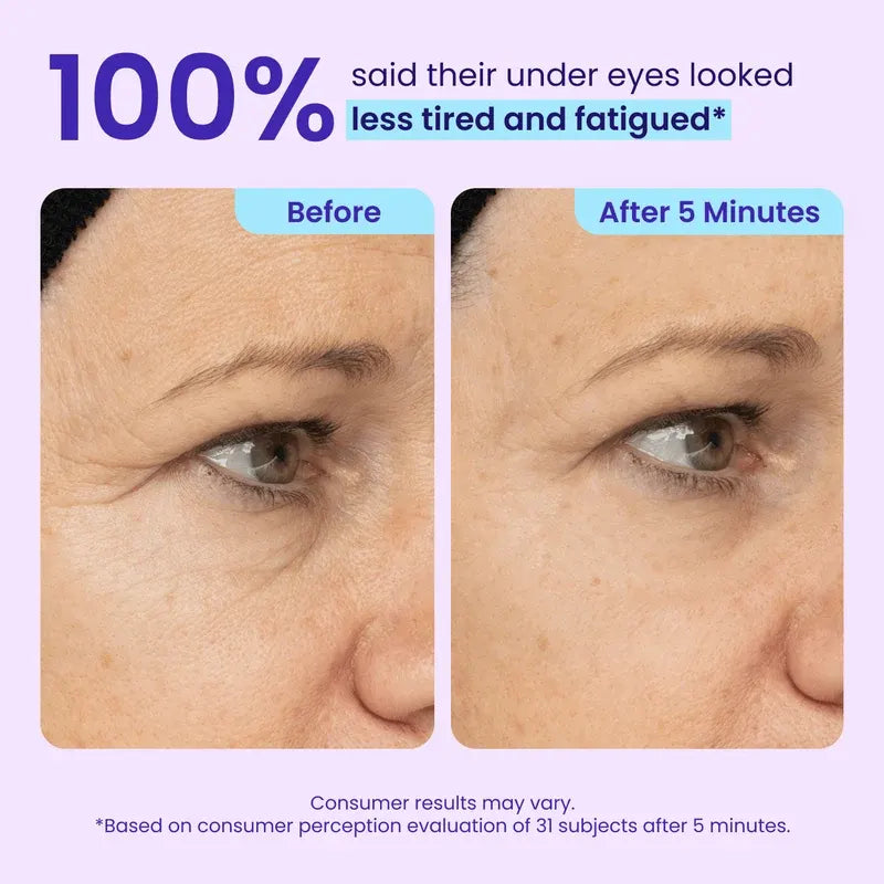 Instant Lift Eye Gel for Under-Eye Bags, Puffiness & Fine Lines