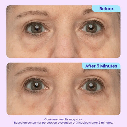 Instant Lift Eye Gel for Under-Eye Bags, Puffiness & Fine Lines