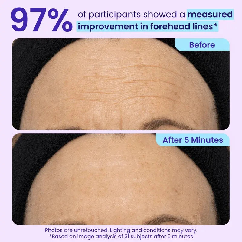 Instant Lift Eye Gel for Under-Eye Bags, Puffiness & Fine Lines