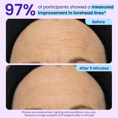 Instant Lift Eye Gel for Under-Eye Bags, Puffiness & Fine Lines