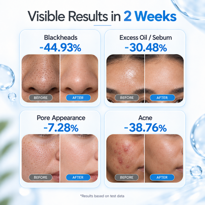 Dluvivo® Zero Pore Pads – Dual-Texture AHA + BHA Pore Care Pads